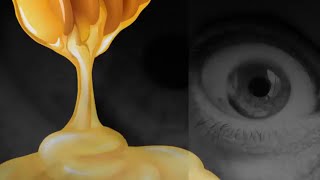 How to Remove Dark Circles -177 | How to Remove Dark Circles QUICKLY at Home Remedy -1(2018)#MrFatty
