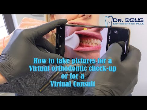 How to take your own teeth photos for a virtual appointment with Dr. Doug!