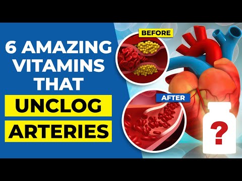 6 Amazing Vitamins that Unclog Arteries