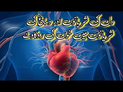 دل کی شریانوں اور دماغ کی شریانوں میں خون کی روکاوٹ || Health Tips Home