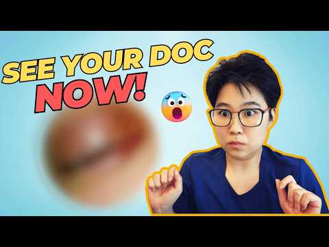 A swollen eye lid gone wild | Preseptal cellulitis | Orbital cellulitis