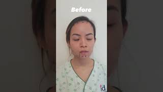 Full Face Transformation