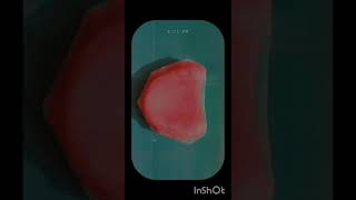Record base / Denture base || Prosthodontics|| BDS shorts