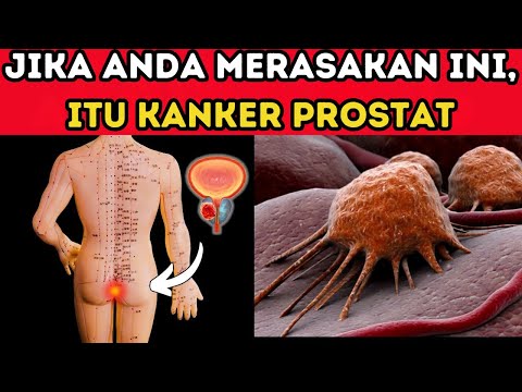 🚨 Kenali Gejala Kanker Prostat Sebelum Terlambat! ⚠️💙
