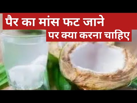 पैर का मांस फट जाने पर क्या करना चाहिए maas fatna ka ilaj in hindi