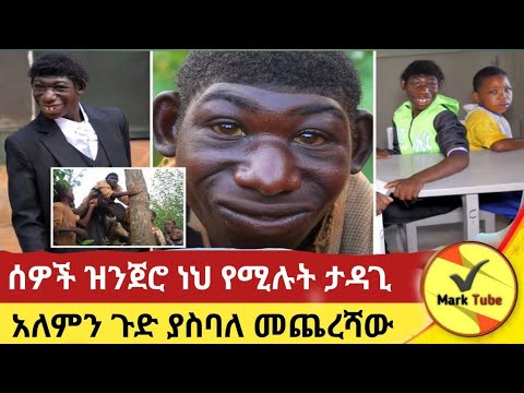 ያሳድዱት የነበሩት ፎቶ ለመነሳት ይማፀኑት ጀመር #inspiration #lifechanging #motivation #historytaking #