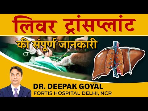 KNOW EVERYTHING ABOUT LIVER TRANSPLANT