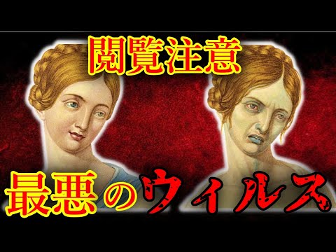 【閲覧注意】人類を襲ったパンデミック・感染症5選【ゆっくり解説】