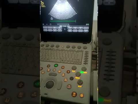 cardiac technology , view of echo machine, knobology