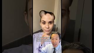 Scalp Reconstruction After Melanoma Removal- Before and After!