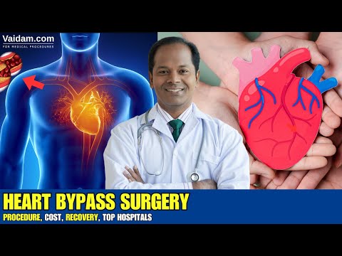 Heart Bypass Surgery in India - Cost, Procedure, and Recovery