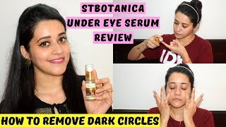 How To Remove Dark Circles | StBotanica Under Eye Serum Review | Just another girl