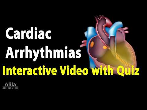 NEW: INTERACTIVE Animation with Quiz: Cardiac Arrhythmias