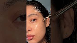 Today we’re using the SkinCeuticals Phloretin CF serum to reduce discoloration and even skin tone.