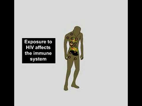 AIDS