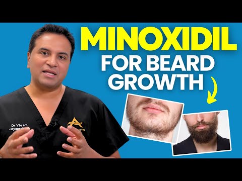 Minoxidil for Beard Growth