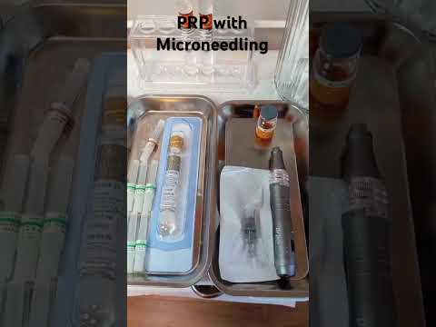 Fast introduction to PRP with microneedling for full facial rejuvenation. #prpfacelift #prp