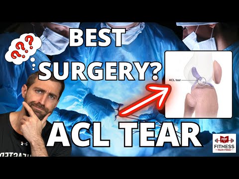 ACL Tear Surgery FACE-OFF [Which is BEST for Patients?]