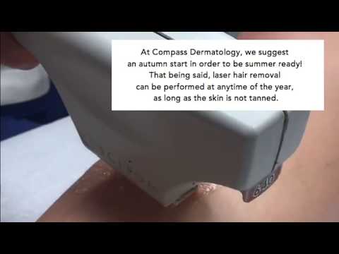 Laser Hair Removal