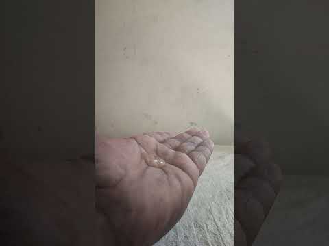 Clean hand #clear #care #health