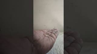 Clean hand #clear #care #health