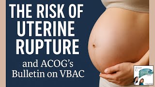 The Risk of Uterine Rupture and ACOG's Bulletin on VBAC | Down To Birth Show