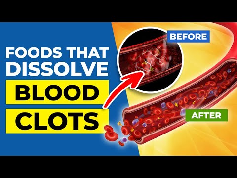 TOP 7 FOODS that Dissolve BLOOD CLOTS