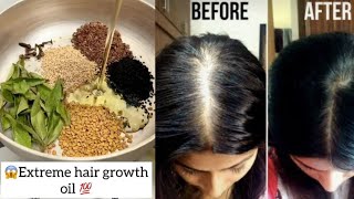 Hair oil remedy /बालो का तेल #hairgrowthoil #oil#viral #viralvideos #homeremedy #hairproblemsolution