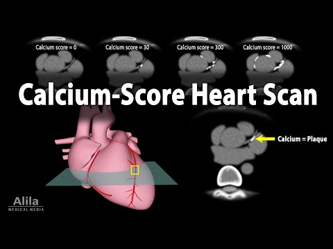 Calcium Score Heart Scan, Animation