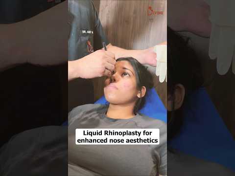 Enhance Your Nose Instantly with Liquid Rhinoplasty – No Surgery Needed! #ytshorts