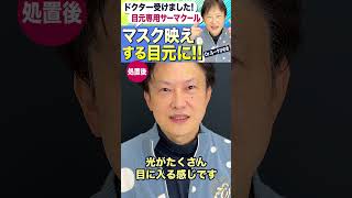 【ドクター受けました！】目元専用サーマクール★切らずに目元のたるみ・しわをアップ#shorts