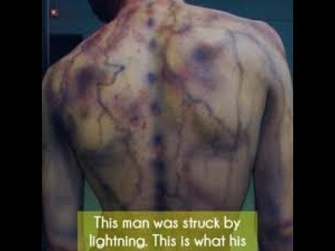 Almost Struck by Lightning Compilation