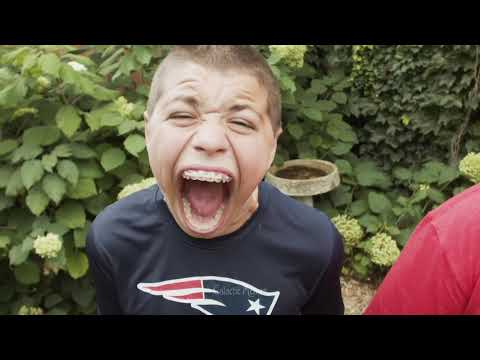 World Biggest Mouth Gape!