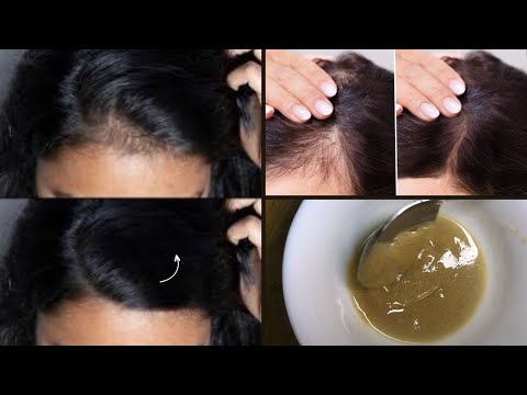 Get long & thick hair| reduce hair Fall|Regrowth your hair| Hair growth challange