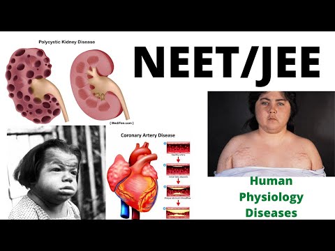 Complete Diseases of Human Physiology in 40 min. with Super Tricks | NEET 202O | 3 Ques. Guaranteed.
