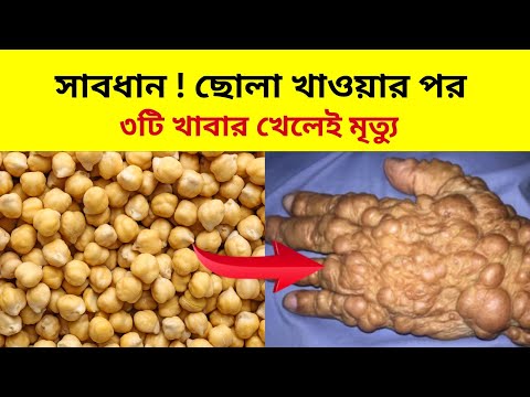 ছোলা খাওয়ার পর ৩ টি খাবার খেলেই হবে মৃত্যু | কাঁচা ছোলা খাওয়ার পর ভুলেও ৩টি খাবার খাবেন না