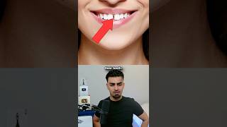 Do You Have a Rare Body? 🤔