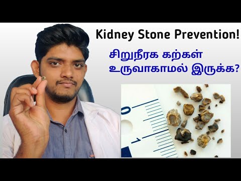 How to prevent kidney Stones, சிறுநீரக கற்கள் வராமல் இருக்க?Episode-5....