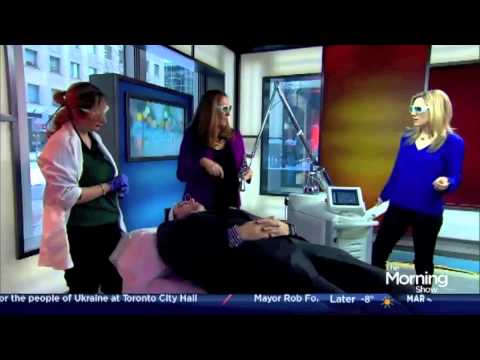 Dr. Carroll Demonstrates Sciton's NanoLaserPeel