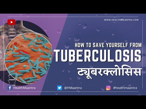 #TUBERCULOSIS: Symptoms &Treatment | #ट्यूबरकुलोसिस | टीबी | Tb ki bimari kaise hoti hai | #टीबी