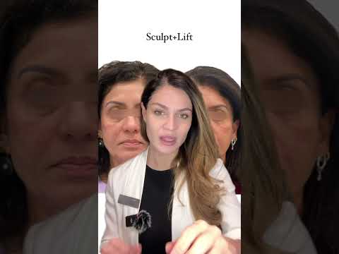 ✨Sculpt+Lift treatment explained✨.#injectablestoronto #fillertoronto #sculptratoronto