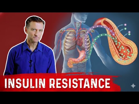28 Insulin Resistance Symptoms You Should NEVER Ignore | Dr. Berg Style Explanation