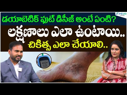 Diabetic Foot Ulcers causes and Symptoms | Diabetic foot | Dr. Manikanth | Sakshi Life