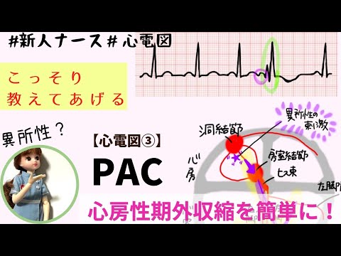 【心電図読み方③】PAC心房性期外収縮を読む！！#看護師#勉強#新人ナース