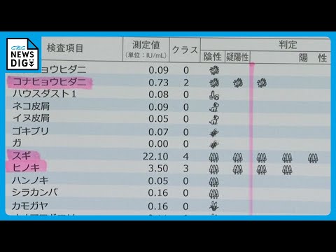 子どもの花粉症が増加？ 医師「小児と成人で1対2ぐらいの比率」その症状“風邪”ではなく“花粉症”かも…