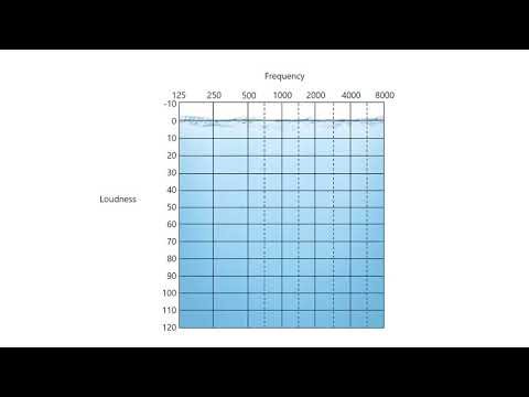 The First Audiogram (Mild)