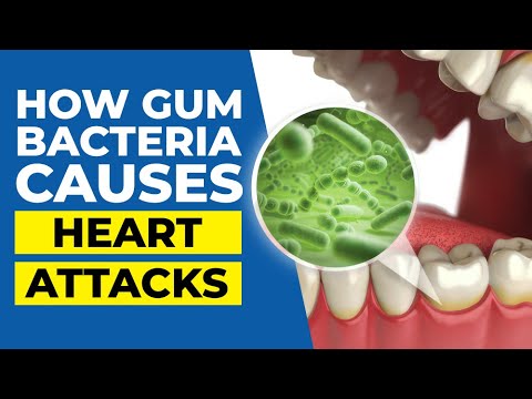 The SCARY Link Between Mouth Bacteria and Heart Attacks