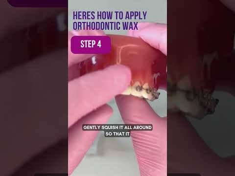 How to use Orthodontic Wax