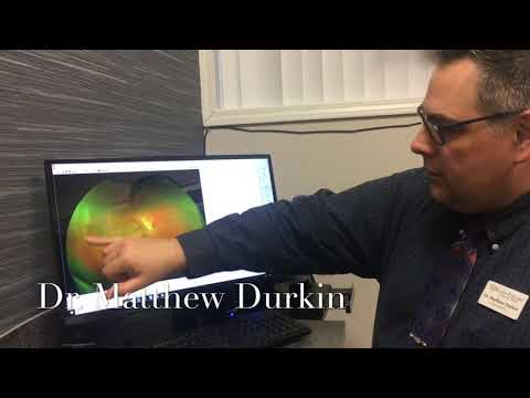 Dr Durkin Optomap in Focus