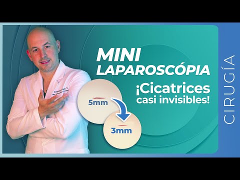 Laparoscópia Mínimamente Invasiva / MINI-Manga Gástrica